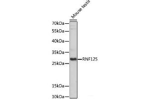 Western blot analysis of extracts of Mouse testis using RNF125 Polyclonal Antibody at dilution of 1:1000. (RNF125 Antikörper)