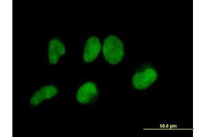 Immunofluorescence of purified MaxPab antibody to METTL3 on HeLa cell. (METTL3 Antikörper  (AA 1-580))
