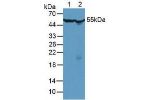 Figure. (CCT2 Antikörper  (AA 1-488))