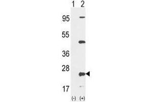 Western blot analysis of PTP4A2 (arrow) using rabbit polyclonal PTP4A2 Antibody (Center) . (PTP4A2 Antikörper  (Middle Region))