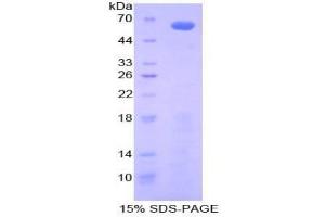 SDS-PAGE analysis of Mouse Insulin Like Growth Factor Binding Protein 2 (IGFBP2) Protein.