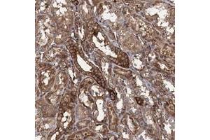 Immunohistochemical staining of human kidney with KIAA1524 polyclonal antibody  shows strong cytoplasmic positivity in renal tubules at 1:200-1:500 dilution.