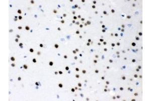 IHC testing of FFPE mouse brain with MEF2A antibody.
