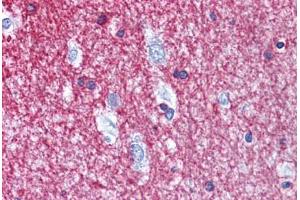Human Brain, cortex: Formalin-Fixed, Paraffin-Embedded (FFPE) (Cnpase Antikörper  (AA 122-352))