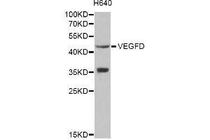 Western blot analysis of extracts of H640 cells, using VEGFD antibody (ABIN1872695) at 1:1000 dilution. (VEGFD Antikörper)
