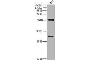 Western Blot Positive WB detected in: 293 whole cell lysate All lanes: CAMK2A antibody at 1:2000 Secondary Goat polyclonal to rabbit IgG at 1/50000 dilution Predicted band size: 55, 56 kDa Observed band size: 55 kDa (CAMK2A Antikörper  (AA 321-478))