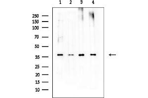 Western blot analysis of lysates from various samples, using Nucleophosmin Mouse Monoclonal Antibody at 1/1000 dilution.