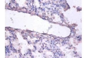 Immunohistochemistry of paraffin-embedded human lung tissue using ABIN7151790 at dilution of 1:100 (ERH Antikörper  (AA 2-104))