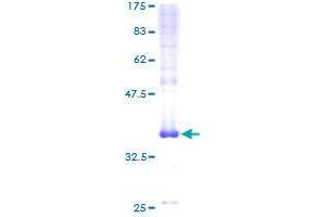 Image no. 1 for Chromosome 20 Open Reading Frame 30 (C20orf30) (AA 1-120) protein (GST tag) (ABIN1347428)