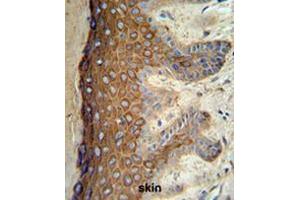 KRT1 Antibody (Center) IHC analysis in formalin fixed and paraffin embedded skin tissue followed by peroxidase conjugation of the secondary antibody and DAB staining. (Cytokeratin 1 Antikörper  (Middle Region))