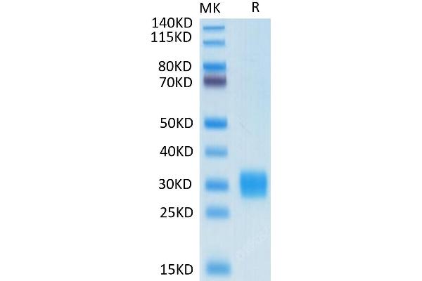 ULBP1 Protein (His-Avi Tag,Biotin)