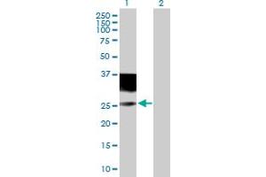 Western Blot analysis of IL4R expression in transfected 293T cell line by IL4R MaxPab polyclonal antibody. (IL4 Receptor Antikörper  (AA 1-227))