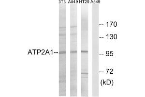 Western blot analysis of extracts from NIH/3T3 cells, A549 cells and HT-29 cells, using ATP2A1 antibody. (ATP2A1/SERCA1 Antikörper  (Internal Region))