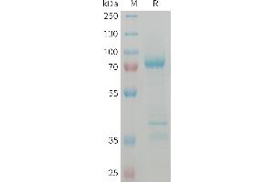SDS-PAGE (SDS) image for Myostatin (MSTN) (AA 24-375) protein (Fc Tag) (ABIN7538400)