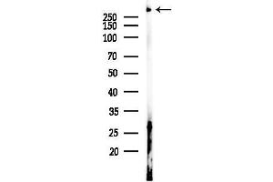 Western blot analysis of lysates from Rat liver, using Collagen XII alpha 1 Antibody at 1/1000 dilution.