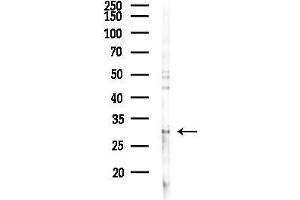anti-Ring Finger Protein 170 (RNF170) antibody