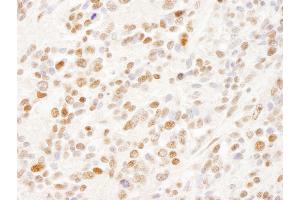 anti-Splicing Factor, Arginine/serine-Rich 14 (SFRS14) (AA 725-775) antibody