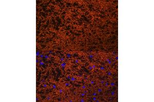 Immunofluorescence (IF) image for anti-Synaptosomal-Associated Protein, 25kDa (SNAP25) (AA 1-206) antibody (ABIN3021232)
