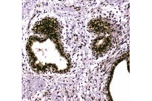 Immunohistochemistry (IHC) image for anti-SUMO1 Activating Enzyme Subunit 2 (UBA2) antibody (ABIN5708279)