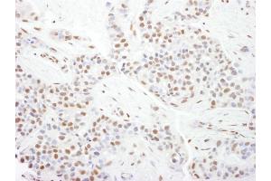 Immunohistochemistry (IHC) image for anti-Cyclin-Dependent Kinase 9 (CDK9) (AA 322-372) antibody (ABIN7453621)
