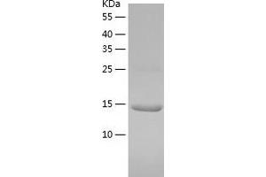 Western Blotting (WB) image for Cystatin S (CST4) (AA 21-141) protein (His-IF2DI Tag) (ABIN7122557)