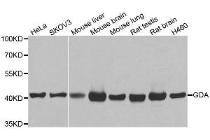 Western blot analysis of extracts of various cell lines, using GDA antibody. (GDA Antikörper)