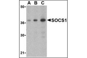 Western blot analysis of SOCS1 in Human spleen cell lysate with this product at (A) 1, (B) 2 and (C) 4 μg/ml. (SOCS1 Antikörper  (C-Term))