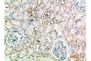 Immunohistochemical analysis of paraffin-embedded human-kidney, antibody was diluted at 1:200 (L1CAM Antikörper  (AA 151-200))