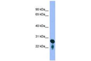 Image no. 1 for anti-RAB5C, Member RAS Oncogene Family (Rab5c) (C-Term) antibody (ABIN6745664) (Rab5c Antikörper  (C-Term))
