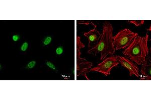 ICC/IF Image Cyclin A2 antibody detects Cyclin A2 protein at nucleus by immunofluorescent analysis. (Cyclin A Antikörper  (C-Term))