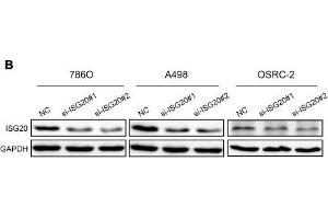 ISG20 promoted ccRCC cell proliferation in vitro. (GAPDH Antikörper)