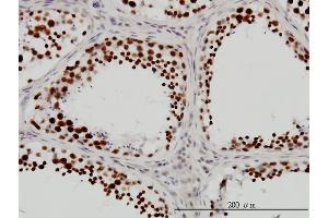 Immunoperoxidase of monoclonal antibody to DHX9 on formalin-fixed paraffin-embedded human testis. (DHX9 Antikörper  (AA 1-90))