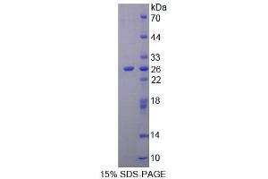 SDS-PAGE (SDS) image for Ninein (GSK3B Interacting Protein) (NIN) (AA 1-153) protein (His tag) (ABIN6239014)