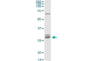 ARHGDIB MaxPab rabbit polyclonal antibody. (ARHGDIB Antikörper  (AA 1-201))