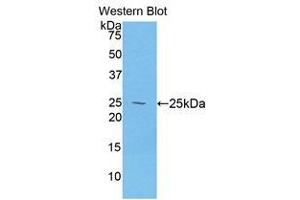 Western Blotting (WB) image for anti-Desmocollin 1 (DSC1) (AA 486-686) antibody (ABIN1858667)