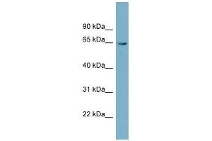 PGM3 antibody used at 1 ug/ml to detect target protein. (Phosphoglucomutase 3 Antikörper  (N-Term))