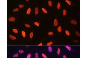 Immunofluorescence analysis of U-2 OS cells using DiMethyl-Histone H3-K14 Polyclonal Antibody at dilution of 1:100 (40x lens). (Histone 3 Antikörper  (2meLys14))