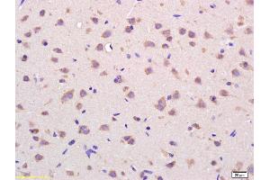 Formalin-fixed and paraffin embedded rat brain labeled with Rabbit Anti VDAC Polyclonal Antibody, Unconjugated (ABIN686872) at 1:200 followed by conjugation to the secondary antibody and DAB staining (VDAC1 Antikörper  (AA 85-190))