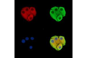 ABIN7096488 and ABIN7100552 staining Hela cells by IF/ICC. (SNTG2 Antikörper)