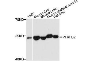 Western blot analysis of extracts of various cell lines, using PFKFB2 antibody. (PFKFB2 Antikörper  (AA 446-505))