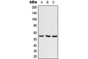 Western blot analysis of SFRS11 expression in NCI-H292 (A), SP2/0 (B), H9C2 (C) whole cell lysates. (SRSF11 Antikörper  (Center))