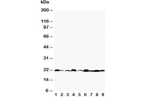 Western blot testing of Bax antibody and Lane 1:  rat testis;  2: rat kidney;  3: rat brain;  4: rat ovary;  5: HeLa;  6: MM231;  7: A549;  8: Jurkat;  9: human placenta tissue lysate