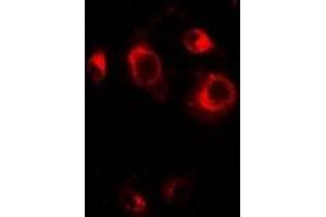 Immunofluorescent analysis of GRASP65 staining in A549 cells. (GORASP1 Antikörper)