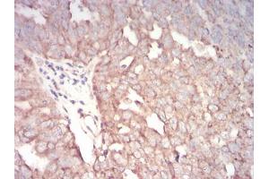 Immunohistochemistry (IHC) image for anti-Transcription Factor AP-2 alpha (Activating Enhancer Binding Protein 2 Alpha) (TFAP2A) (AA 1-100) antibody (ABIN5542420)