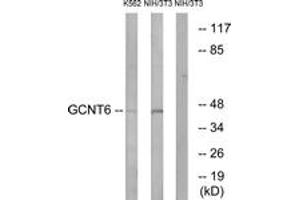 Western blot analysis of extracts from NIH-3T3/K562 cells, using GCNT6 Antibody. (GCNT6 Antikörper  (AA 201-250))