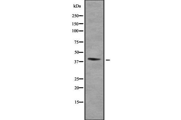 HOXA2 antibody  (Internal Region)