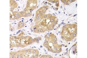 Immunohistochemistry of paraffin-embedded Human kidney using RPS4X Polyclonal Antibody at dilution of 1:100 (40x lens). (RPS4X Antikörper)