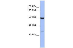 WB Suggested Anti-ZFP28 Antibody Titration:  0. (ZFP28 Antikörper  (Middle Region))