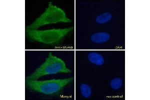 ABIN185659 Immunofluorescence analysis of paraformaldehyde fixed HeLa cells, permeabilized with 0. (Hsc70 Antikörper  (Internal Region))