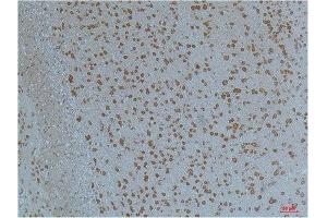 Immunohistochemistry (IHC) analysis of paraffin-embedded Mouse Brain Tissue using Kv11. (KCNH2 Antikörper)